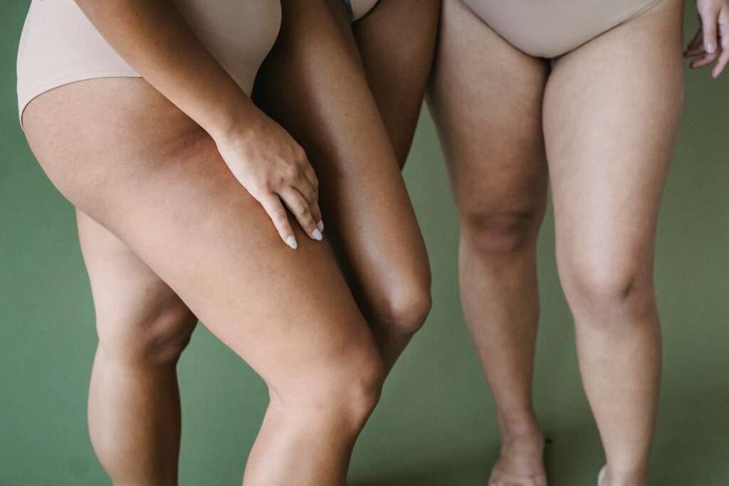 Celebrating body positivity and diversity with two women in neutral underwear against a green background.